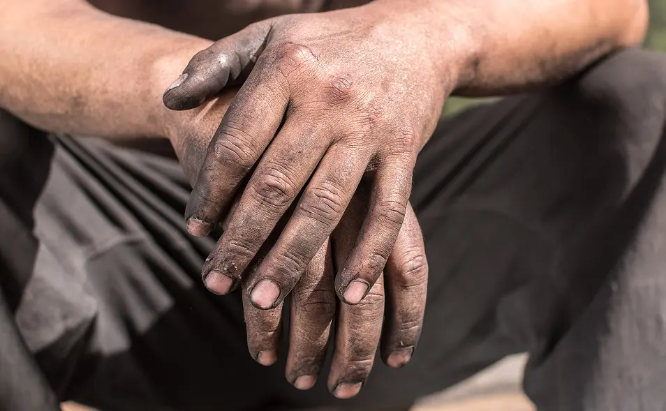 Dirty hands
